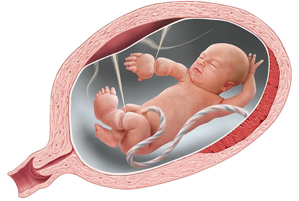 Amniotik bağlar nədir?