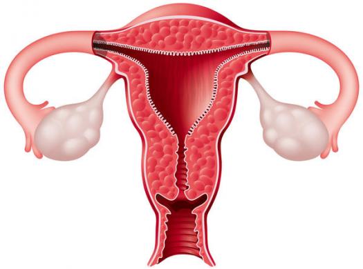 endometriumun vəzili hiperplaziyası nədir?