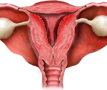 Düz bağırsağın endometriozunun səbəbləri